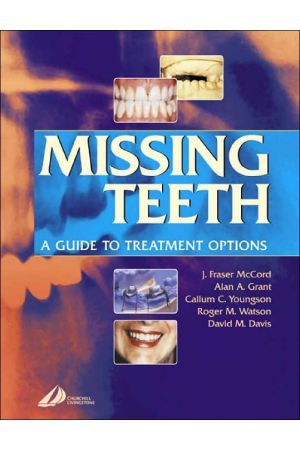 Missing Teeth: A Guide to Treatment Options