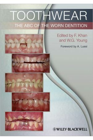 Toothwear: The ABC of the Worn Dentition