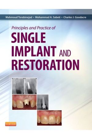 Principles and Practice of Single Implant and Restoration