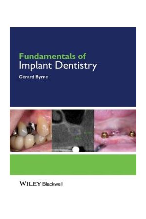 Fundamentals of Implant Dentistry