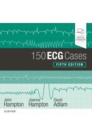 150 ECG Cases, International Edition, 5th Edition