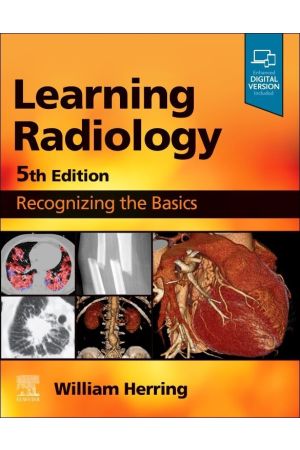 Learning Radiology, 9780323878173