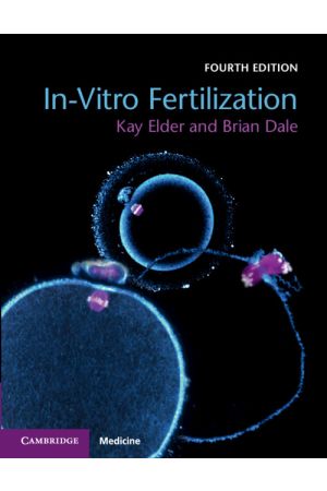 In-Vitro Fertilization